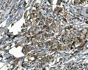 Anti-SGK1 Antibody