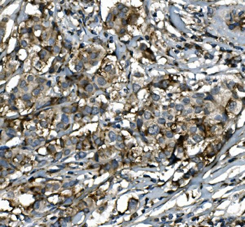Anti-SGK1 Antibody