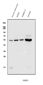 Anti-SGK1 Antibody