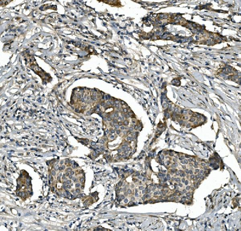Anti-STAT6 Antibody