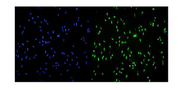 Anti-Transketolase/TKT Antibody