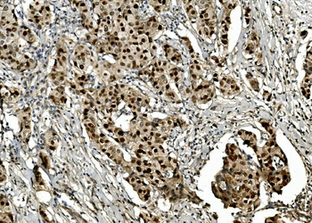 Anti-Transketolase/TKT Antibody