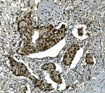 Anti-Transketolase/TKT Antibody