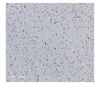 Anti-Transketolase/TKT Antibody