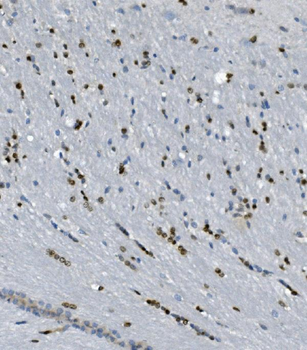 Anti-Transketolase/TKT Antibody