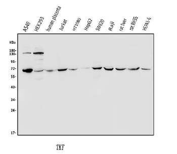 Anti-Transketolase/TKT Antibody