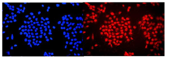 Anti-WAC Antibody