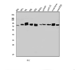 Anti-WAC Antibody