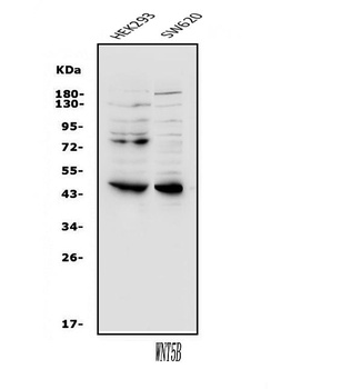 Anti-Wnt5b Antibody