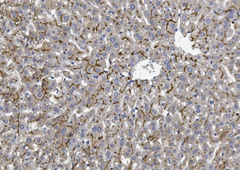 Anti-BCRP/ABCG2 Antibody