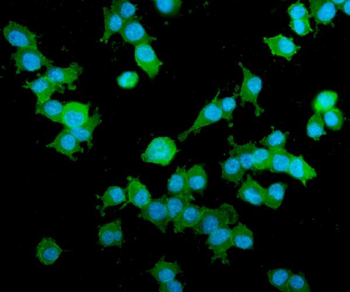 Anti-AKAP12 Antibody