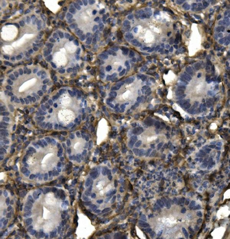 Anti-AKAP12 Antibody