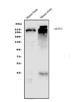 Anti-AKAP12 Antibody