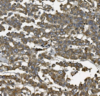 Anti-ALDH1L1 Antibody