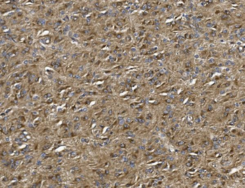Anti-ALDH1L1 Antibody