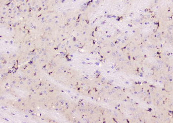 Anti-ALDH1L1 Antibody