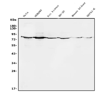 Anti-Alkaline phosphatase/ALPL Antibody
