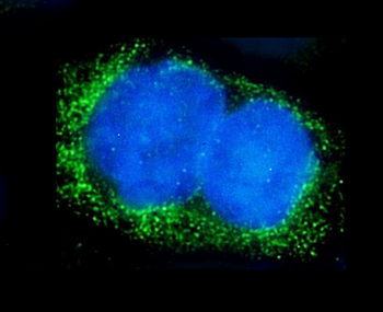 Anti-Alkaline phosphatase/ALPL Antibody