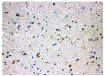Anti-Alkaline phosphatase/ALPL Antibody