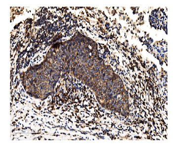 Anti-Alkaline phosphatase/ALPL Antibody