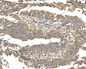Anti-Alkaline phosphatase/ALPL Antibody