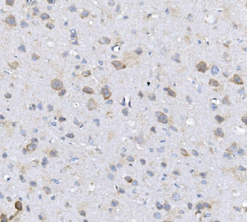 Anti-Alkaline phosphatase/ALPL Antibody