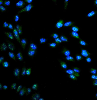Anti-ARG2 Antibody