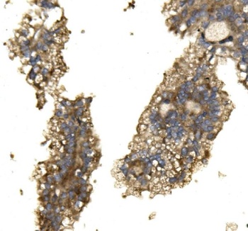 ARG2 Antibody