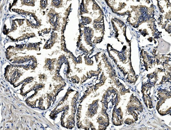 Anti-ARG2 Antibody