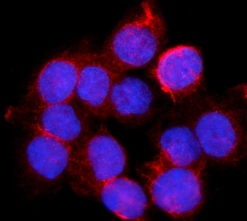 Anti-BDH1 Antibody