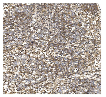 Anti-BDH1 Antibody