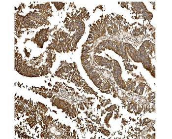 Anti-BDH1 Antibody