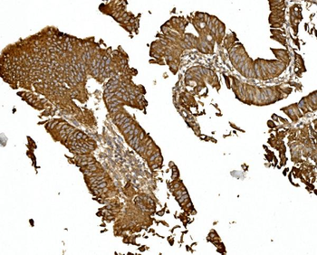 Anti-BDH1 Antibody