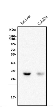 Anti-BDH1 Antibody