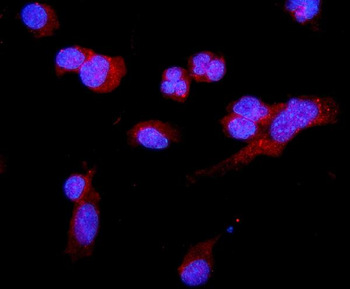 Anti-C5a-R/C5ar1 Antibody
