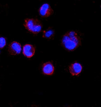 Anti-CD74 Antibody