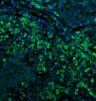 Anti-CD74 Antibody
