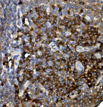 Anti-CD74 Antibody