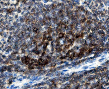 Anti-CD74 Antibody