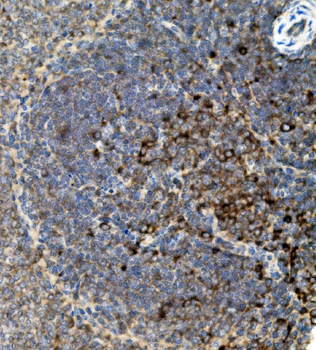 Anti-CD74 Antibody