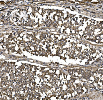 Anti-MitoNEET/CISD1 Antibody