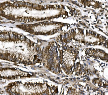 Anti-MitoNEET/CISD1 Antibody