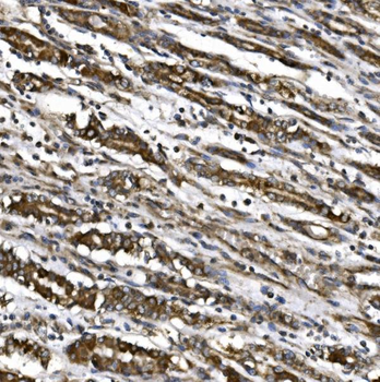 Anti-MitoNEET/CISD1 Antibody
