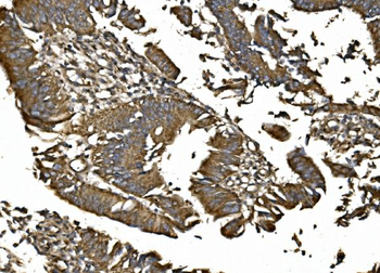 Anti-MitoNEET/CISD1 Antibody