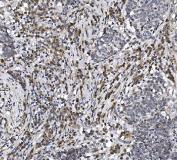 Anti-CISD2 Antibody