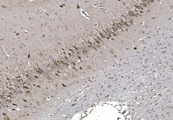 Anti-CISD2 Antibody