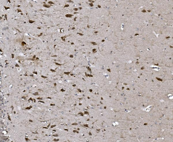Anti-CISD2 Antibody