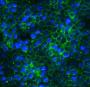 Anti-Claudin 3/CLDN3 Antibody