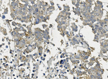 Anti-Claudin 3/CLDN3 Antibody
