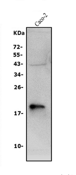 Anti-Claudin 3/CLDN3 Antibody
